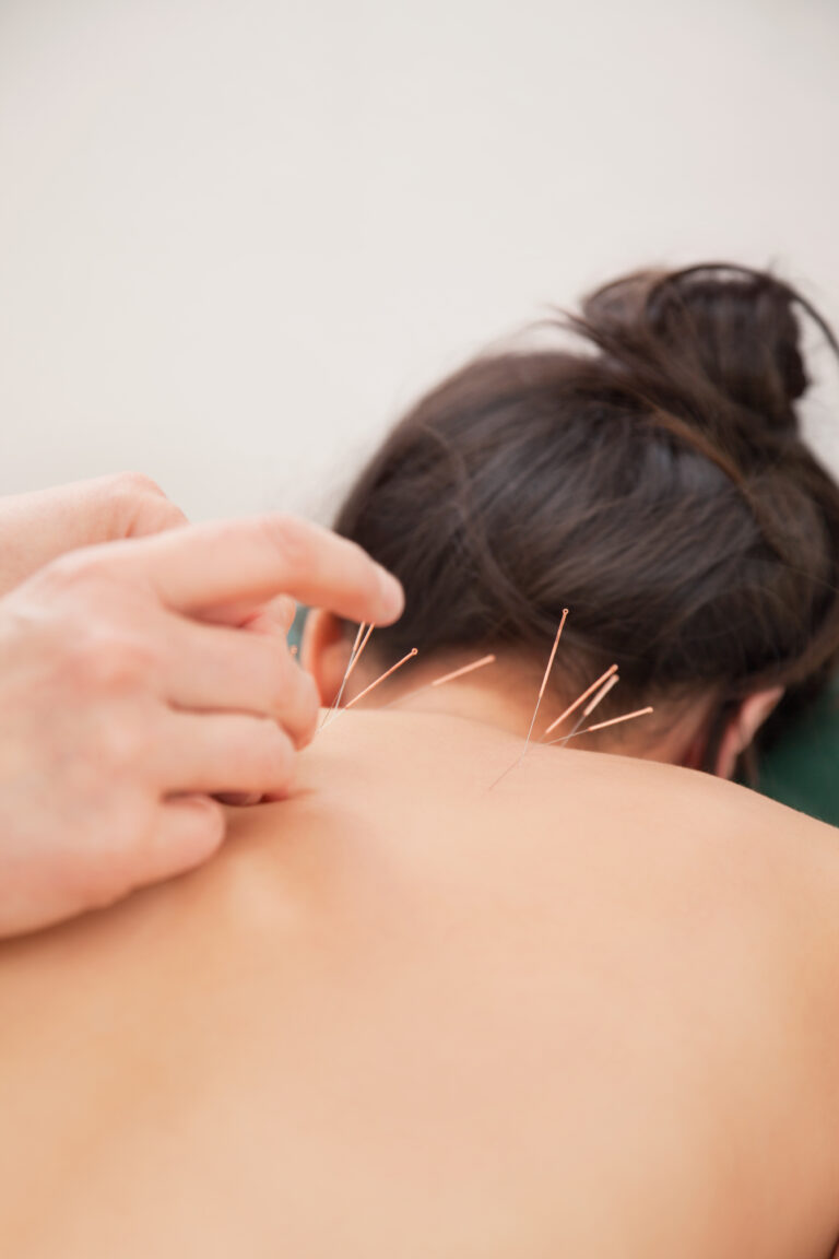Acupuncture, Red Light Therapy and total Wellness at the Village